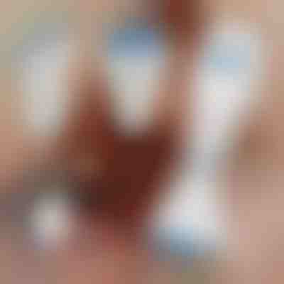 Elektryczny grzebień do usuwania wszy | TREVY